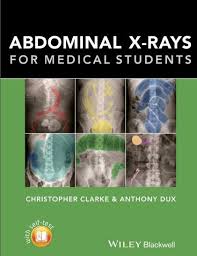 Abdominal X Rays For Medical Students Medical Students Medicine Book X Ray