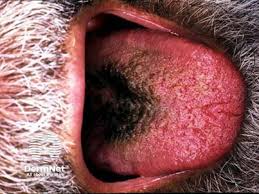 Image result for black hairy tongue symptoms