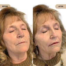 Paul Adkins BSN, RN, FNP-S 💉 (@paultheaestheticinjector) • Instagram  photos and videos