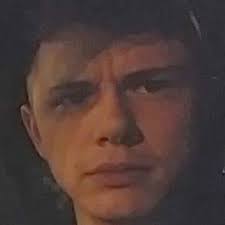 Patient presents because of this round rash