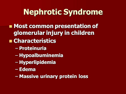 Preeclampsia is the leading diagnosis that must be excluded in all women with proteinuria first identified after 20 weeks of gestation. Nursing Management Of Genitourinary Dysfunction Ppt Video Online Download