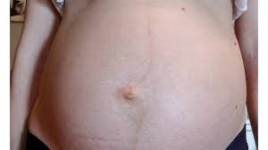 Maybe you would like to learn more about one of these? Linea Nigra Should I Be Worried