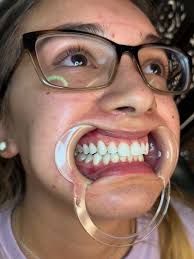 Hope you all are enjoying your day! Have any of you thought about becoming  a teeth whitening professional?