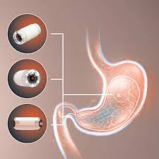 Image result for Virtual Endoscopy