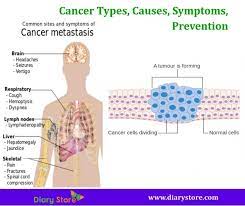 Taking out the cancer or relieving symptoms of the cancer in an operation. Cancers Types Causes Symptoms Prevention All Cancers