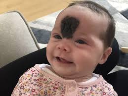 Dad claims NHS refused to operate