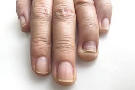 Image result for Beau lines feet