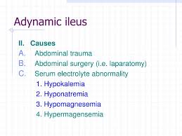 Image result for Adynamic Ileus