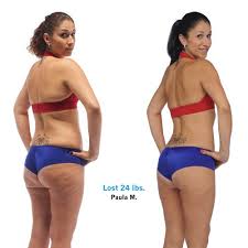 Enjoy the hottest porno videos from any search results for: Daria Nettleton Facebook Com Darianettleton Brazillian Butt Lift Master S Series Challenge