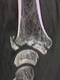 We would like to show you a description here but the site won't allow us. Le Plus Rapide Medipole Radiologie