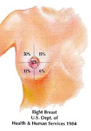 If this is how you feel, let your doctor know that, too. Different Kinds Of Breast Lumps Stony Brook Cancer Center