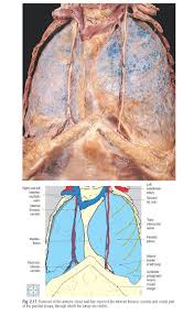 Pleura Anatomy The Thoracic Cavity Lies Within The Walls Of The Thorax And Is Separated From The Abdominal Cav Thoracic Cavity Serous Membrane Pleural Effusion
