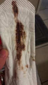 Brown discharge pictures of spotting during pregnancy. 3 Weeks Pregnant Brown Discharge Novocom Top
