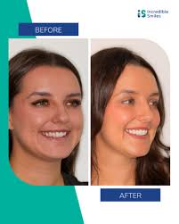 Incredible Smiles (@incrediblesmiles_is_dentist) • Instagram photos and  videos