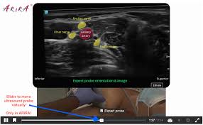 Image result for Axillary Nerve Block