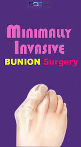 We Get Asked This Question Often What Is The Difference Between Minimally Invasive Surgery And Non Invasive Procedures Bunion Surgery Bunion Surgery
