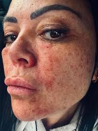 Sending all my love to the incredible and incredibly talented  @davideasterofficial @davidjeaster1 David Easter, who is marrying the  beautiful @tina_barkerx Tina Barker today. I'm truly heartbroken I couldn't  be there, but I'm