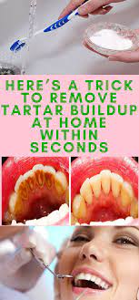 Check spelling or type a new query. How To Reverse Tooth Decay In Dogs Arxiusarquitectura