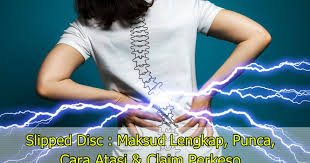 Pembantu penguat kuasa kastam gred kp19; Slipped Disc Maksud Lengkap Punca Cara Atasi Claim Perkeso