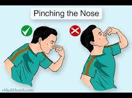 How To Stop Nose Bleeds #Healthytips #Nosebleeds - Youtube