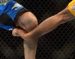 Anderson silva breaks his leg. Ouch Anderson Silva Breaks His Leg On A Checked Kick By Chris Weidman Ufc Jui Jitsu Broken Leg