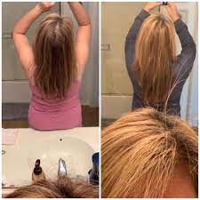 Also, it helps the hair grow faster. Rice Water Rinse For Hair Growth Gloria S Lee