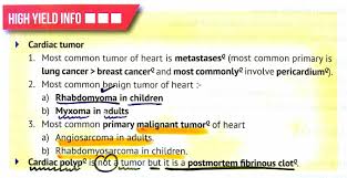 Cardiac Tumors Most Common Myxoma Angiosarcoma Rhabdomyosarcoma Polyp Tumor Cardiac Cancer