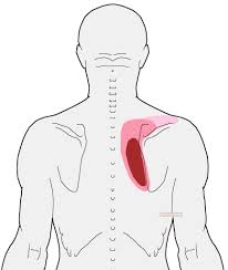 Pin On Cervicalgia