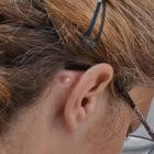 Ma fille a 4mois et demi et en la couchant ce soir j'ai senti des petites boules derriere sa tete , assez. Boule Derriere L Oreille Qu Est Ce Cela Veut Dire Et Que Faire