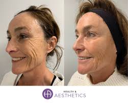 Who is Dr Rekha Tailor?