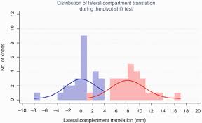 Image result for Pivot Shift Test