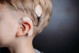 Cochlear implant surgery