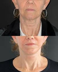 Envelhecimento Natural O processo de #envelhecimento incomoda muito algumas  pessoas, outras, no entanto, lidam super bem com ele. É o caso do talentoso  ator #jimparsons . A comparação dessas fotos, com cerca