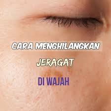 Untuk menghilangkan jerawat secara alami, disarankan untuk membersihkan wajah menggunakan sabun berbahan lembut secara rutin. Blog Lia Cara Menghilangkan Jeragat Di Wajah