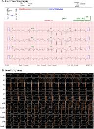 A review of the literature. Artificial Intelligence Algorithm For Predicting Cardiac Arrest Using Electrocardiography Scandinavian Journal Of Trauma Resuscitation And Emergency Medicine Full Text