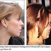 Measuring hair cortisol has attracted interest as a long term parameter for chronic stress evaluation. 1