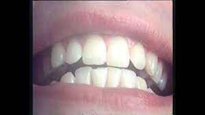 Erobique wann free mp3 download. Erobique Jacques Palminger Wann Strahlst Du Youtube