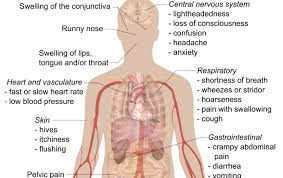 If you're having an anaphylactic reaction, you can follow these steps yourself if you feel able to. Anaphylaxis Dr Caterina Detoraki Zerodonto