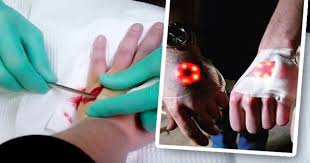 This will hold the circle onto your hand. Iron Man Hand Craze Horrific Video Won T Make You Want To Look Like A Superhero Daily Star