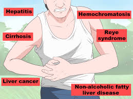 We did not find results for: 3 Ways To Stop Liver Pain Wikihow