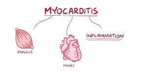 Rest and medication to help your body fight off the infection causing myocarditis might be all you need. Myocarditis Osmosis