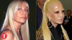 The Biggest Celebrity Plastic Surgery Fails Plastische Chirurgie Schonheit Stars Ungeschminkt
