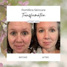 Exfoliating for dry skin in winter months?