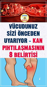 Vucudunuz Sizi Onceden Uyariyor Kan Pihtilasmasinin 8 Belirtisi Dogal Saglik Saglik Ipuclari Saglik Bakim