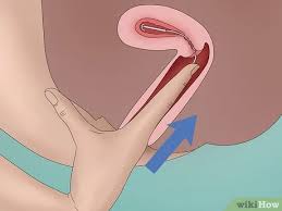 If you feel that they've become shorter or if you can feel the bottom of the iud itself, it means that the iud is out of place and you need medical attention. How To Check Mirena Strings 8 Steps With Pictures Wikihow