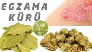 Defne Yapragi Ve Beyaz Dut Ile Egzama Kuru Dogal Defne Yapragi Saglikli