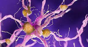 By derek lowe 6 november, 2020. Morbus Alzheimer Fda Lasst Antikorper Aducanumab Entgegen Negativem