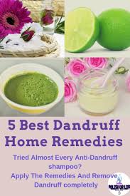 5 Best Dandruff Home Remedies Home Remedies For Dandruff What Is Dandruff Remove Dandruff Home Remedies