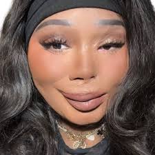 Following all my disabled girlies disability