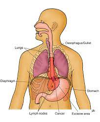 Agencies are cracking down on the sale of stolen goods. Cancer Of The Oesophagus Surgery Abeezar Sarela